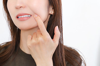 口角下制筋（こうかくかせいきん）への注射：口角を上げて、自然で若々しい口元へ